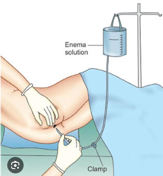 Enema (Anima) slide 2