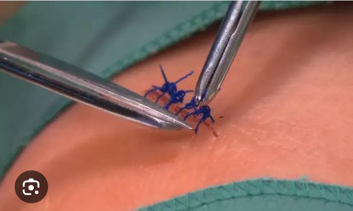 Stitch Removal slide 1